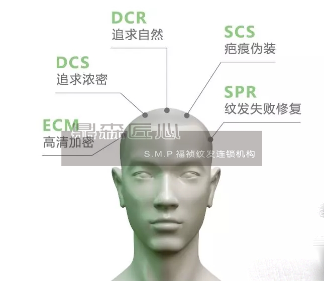 贵州纹发机构解释秃头和光头区别