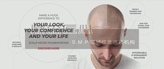 如何用贵州纹发技术掩饰你的秃头