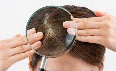 贵阳纹发讲堂：简析关于洗头与脱发关系