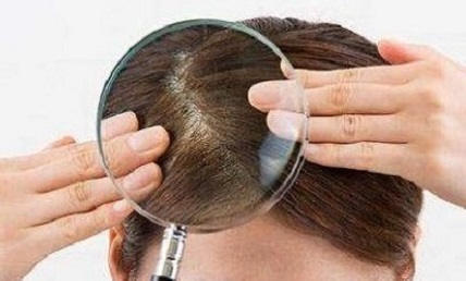治疗脱发有哪两个重要时期？