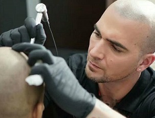 纹发的完整起源史：从古老纹身到现代脱发解决方案