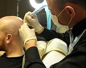 为何贵州纹发常被视为脱发患者“最后选择”? 为何贵州纹发常被视为脱发患者“最后选择”?