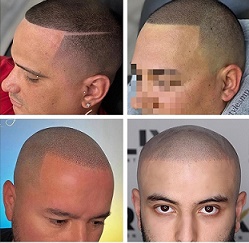 贵阳纹发不仅是视觉上的 “年轻”,更是心理与生活状态的重启 贵阳纹发不仅是视觉上的 “年轻”,更是心理与生活状态的重启