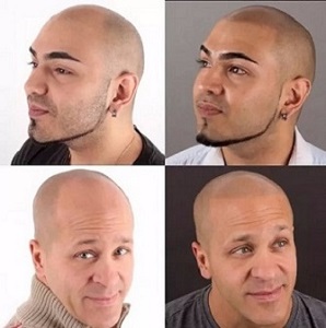 光头纹发公认的主流风格有哪些? 光头纹发公认的主流风格有哪些?