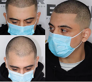 掌握纹发知识，能帮你有效避坑，安心收获理想效果