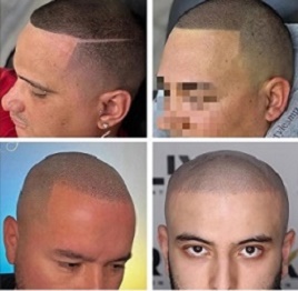 贵阳纹发对于秃头可以打造哪些风格？