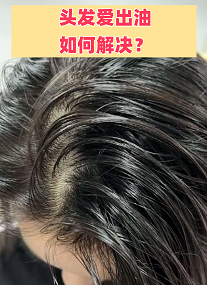 头发爱出油的真相是什么？