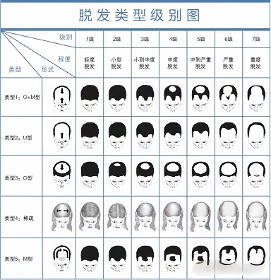 人体头发数量与健康存在双向关联